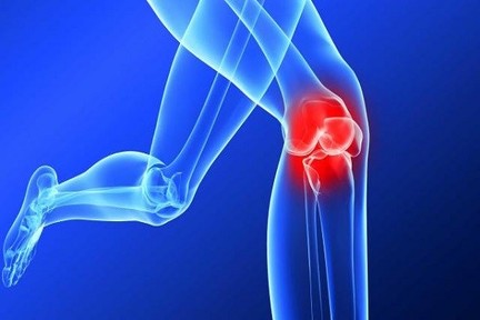 درباره ی پارگی رباط صلیبی بیشتر بدانیم؟