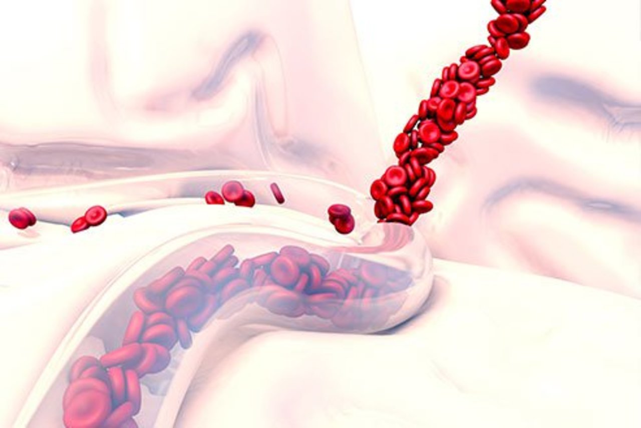 علائم، علل و عوارض خونریزی داخلی