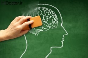 نشانه های آغاز زوال عقل