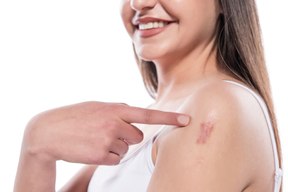 درباره ی کلوئید چه می دانید؟