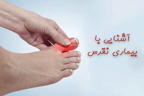 بیماری نقرس چیست؟