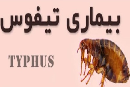 علائم بیماری تیفوس