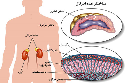 هیپر پلازی مادرزادی ادرنال چیست؟