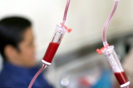 بازماندگان سرطان با افزایش ریسک بیماری قلبی روبرو هستند